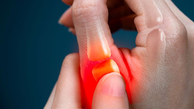 Pourquoi ai je mal au muscle du pouce