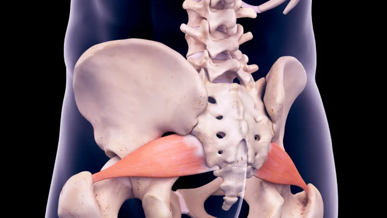 douleur au muscle piriforme